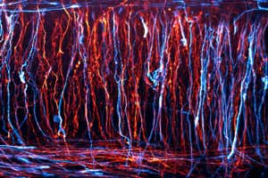 48-hour time-lapse of neurons