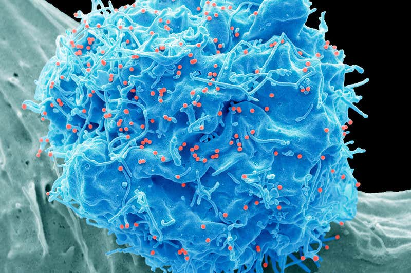 An HIV-infected cell