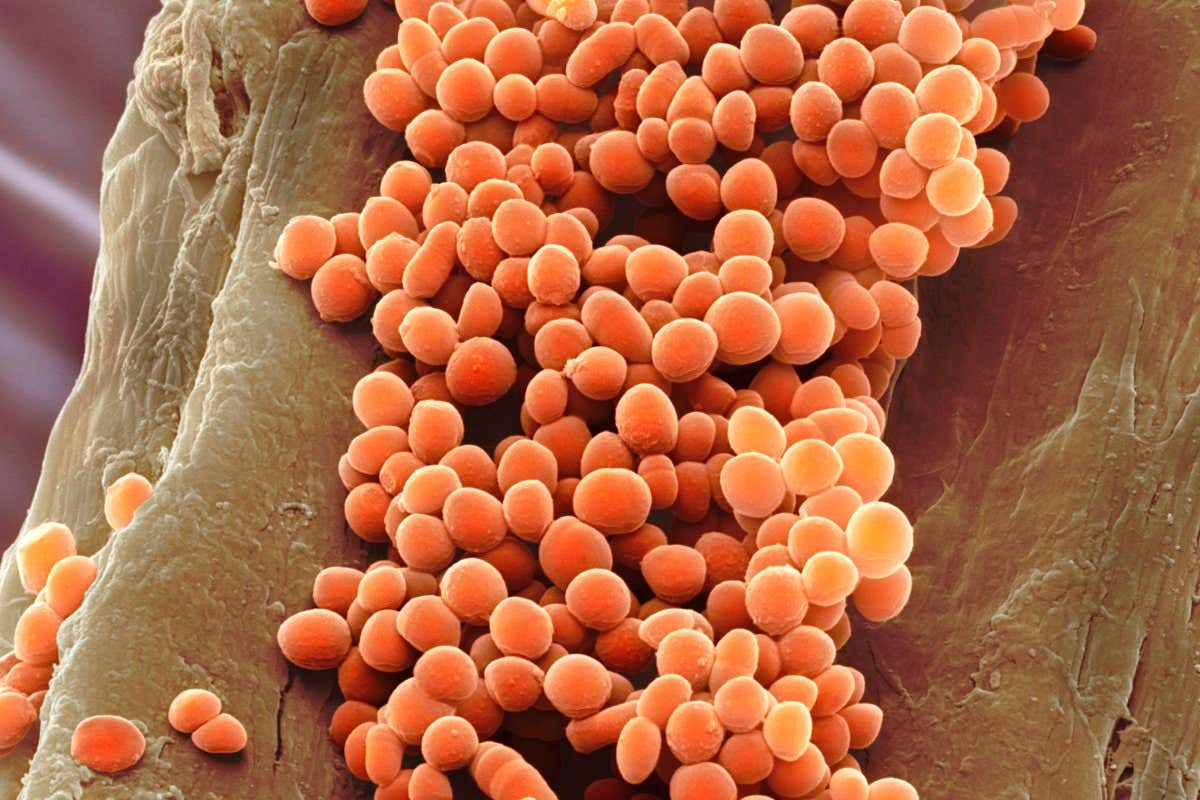 Lactococcus lactis bacteria,coloured scanning electron micrograph (SEM). This lactic acid-producing bacteria is used in the production of cheese and other fermented products. Magnification: x2500 when printed at 10 centimetres wide.